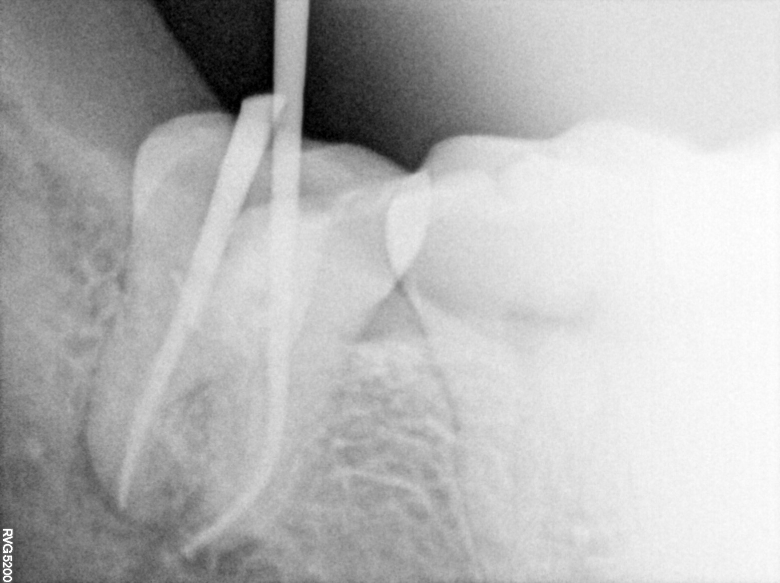 Dental X-ray